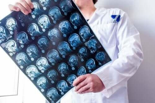 Γιατρός κρατά σπινθηρογράφημα εγκεφάλου