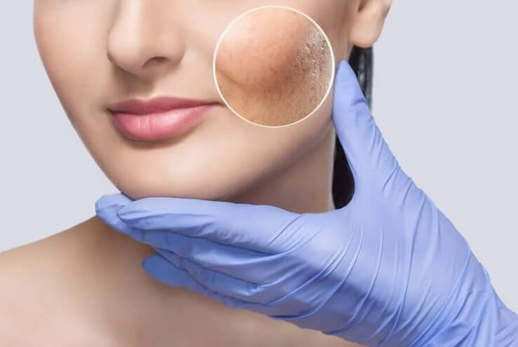 Κηλίδες στο δέρμα