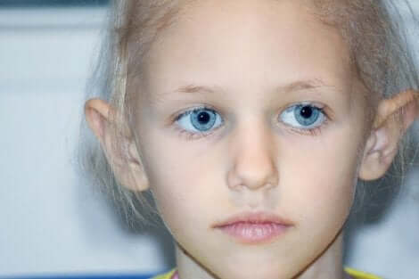 Κοριτσάκι με ρετινοβλάστωμα