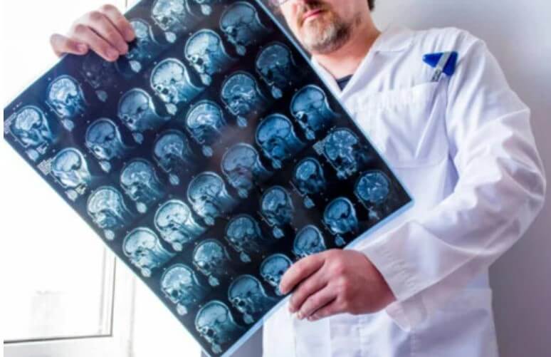 απεικόνιση εγκεφάλου