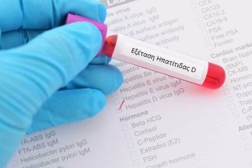 Δείγμα αίματος