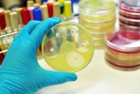 Γιατρός κρατά καλλιέργεια ούρων ουρολοιμώξεις στα παιδιά
