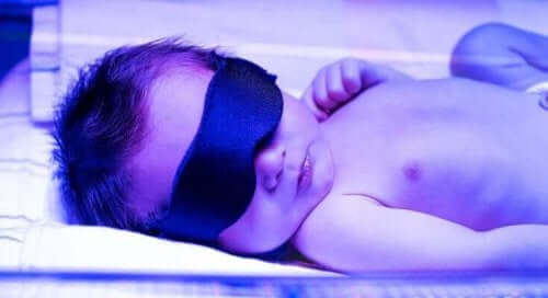 Μωρό σε θάλαμο φωτοθεραπείας