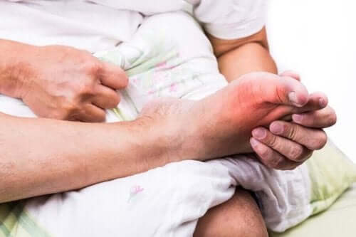 Αλλοπουρινόλη για την ουρική αρθρίτιδα