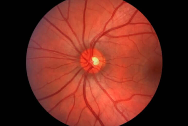 εσωτερικό του ματιού