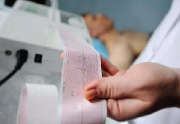 καρδιογράφημα