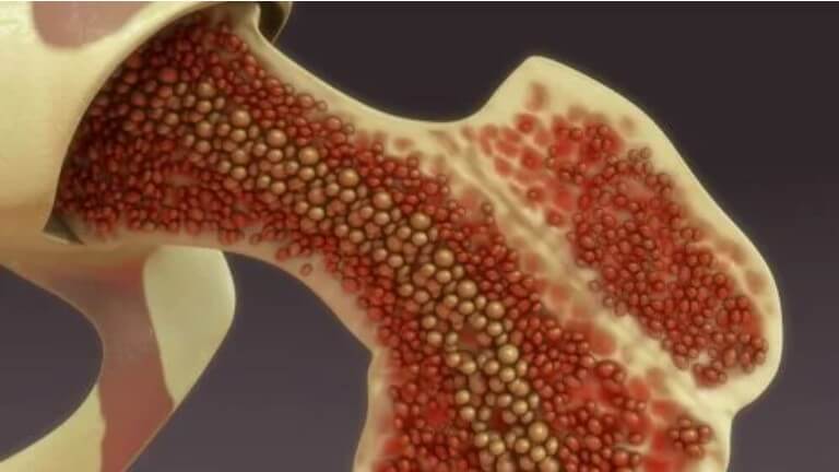 κύτταρα στα οστά