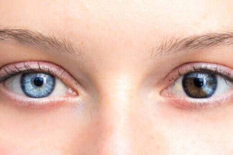 Οι αλλαγές στο χρώμα ματιών μπορεί να είναι ανησυχητικές