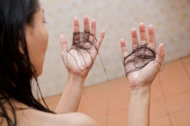 τρίχες σε χέρια