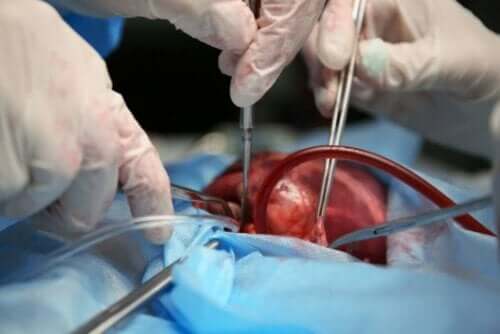 Χειρουργική επέμβαση στην καρδιά