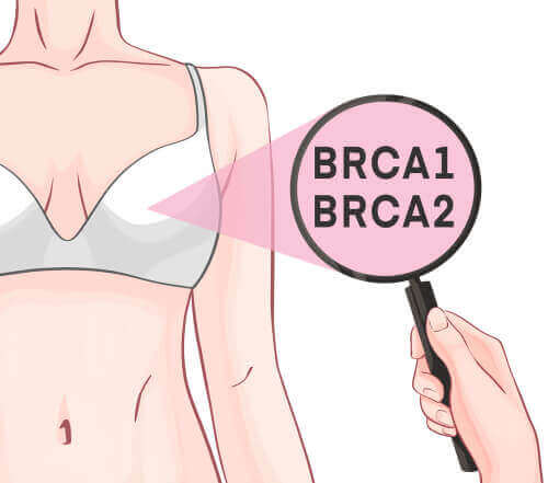 Γονίδια BRCA-1 και BRCA-2 και καρκίνος του μαστού