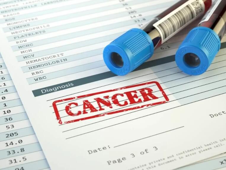 καρκίνος και εξετάσεις