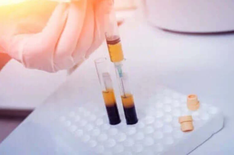 μετάγγιση πλάσματος