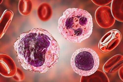 Υψηλά επίπεδα μονοκυττάρων στο αίμα: Συμπτώματα και θεραπείες