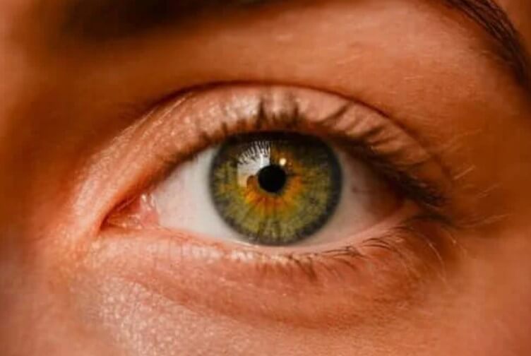Οφθαλμικοί σπίλοι: Είναι επικίνδυνες οι φακίδες των ματιών;
