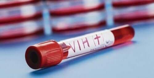 Φιαλίδιο με αίμα θετικό στον HIV
