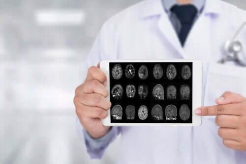 Γιατρός δείχνει ακτινογραφίες εγκεφάλου σε ταμπλέτα