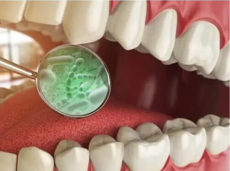 Ποια είναι τα είδη βακτηρίων στο στόμα σας;