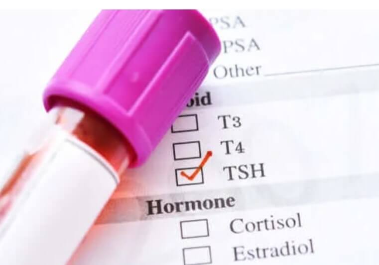 Χαμηλή ορμόνη διέγερσης του θυρεοειδή: Ποιες είναι οι αιτίες