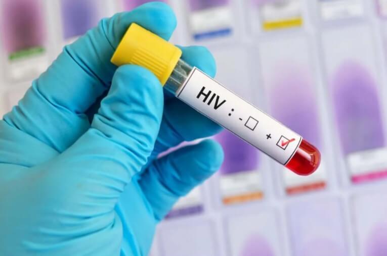 τεστ HIV