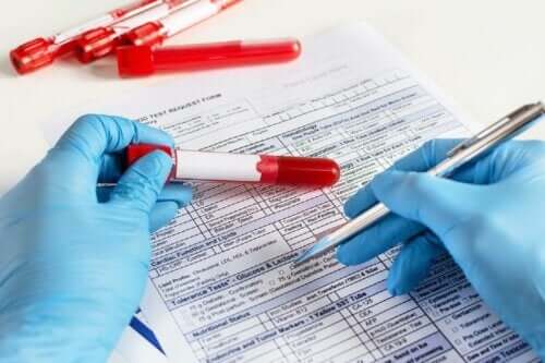 Γιατρός συμπληρώνει τα αποτελέσματα εξετάσεων αίματος