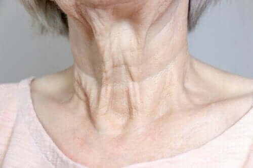 Ηλικιωμένη γυναίκα με ρυτίδες στον λαιμό- διάφορα είδη ρυτίδων