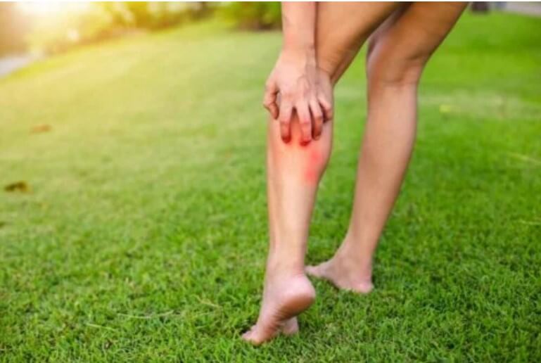 κνησμός στο πόδι