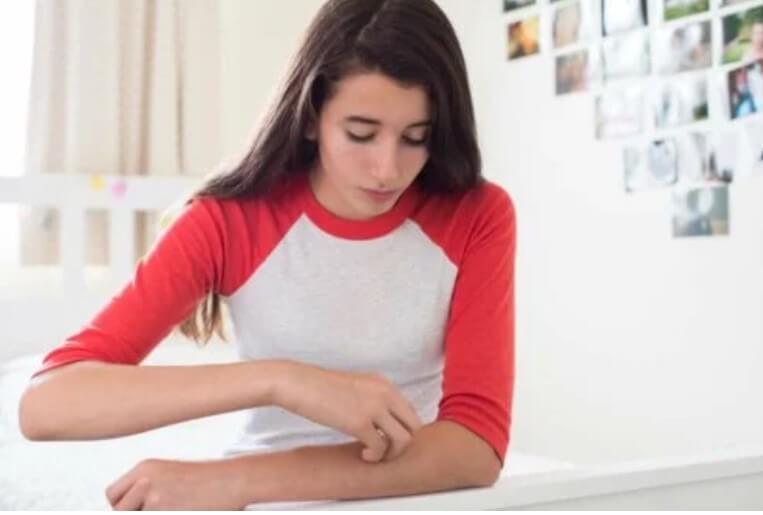 φαγούρα στο χέρι