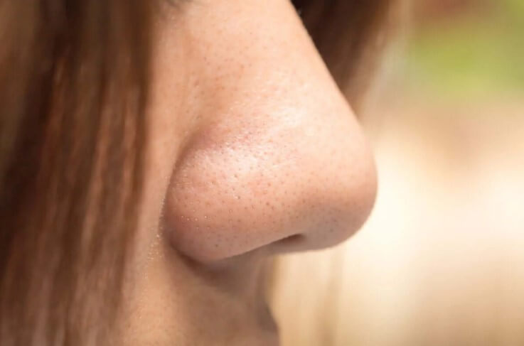 γυναικεία μύτη