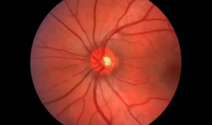 απεικόνιση ματιου