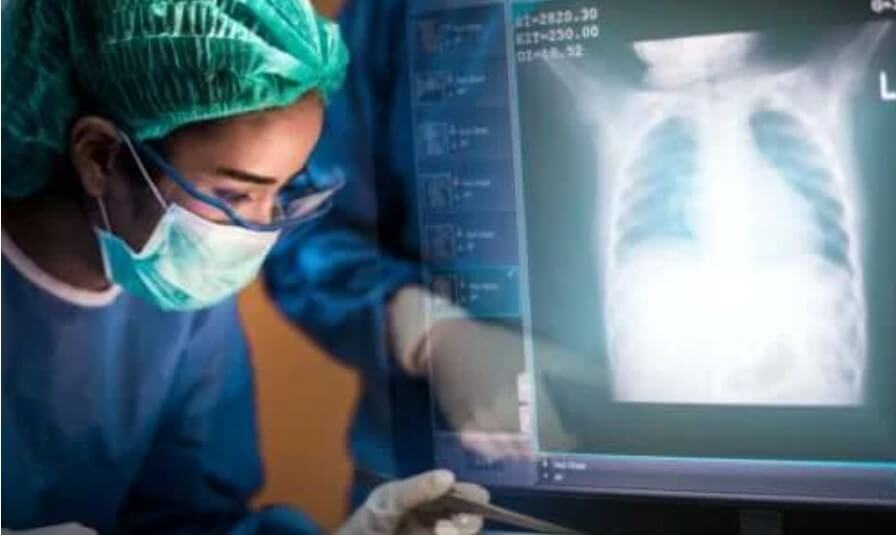 Μεταμόσχευση πνεύμονα: Τι πρέπει να γνωρίζετε
