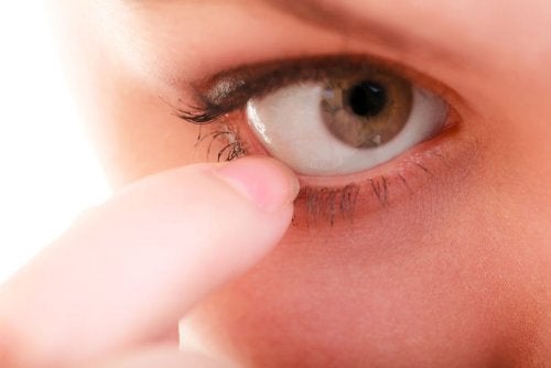 10 φυσικές θεραπείες για τη φαγούρα στα μάτια