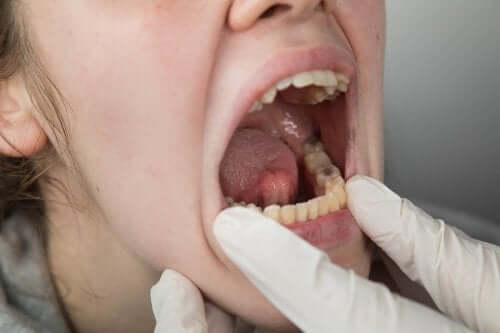 Παράγοντες κινδύνου για καρκίνο του στόματος