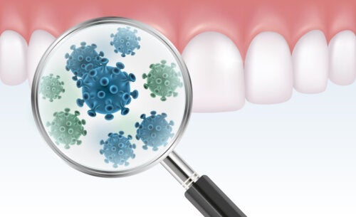 Όλα όσα πρέπει να γνωρίζετε για την οδοντική βακτηριακή πλάκα