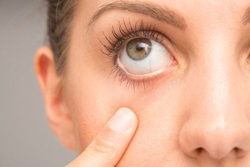 7 συμβουλές για τη θεραπεία του τικ στα μάτια
